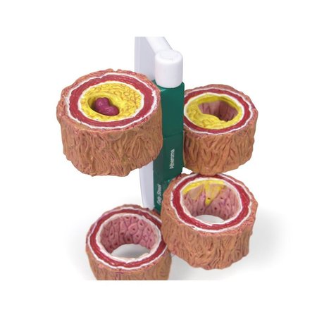 GPI ANATOMICAL Anatomical Model - 4-Piece Artery 2650